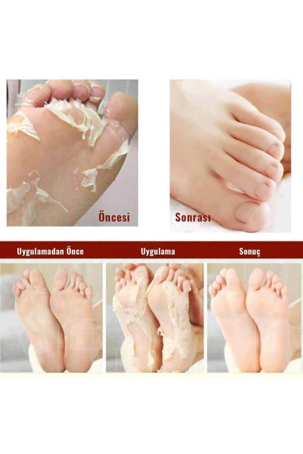 Miracle Foot Peeling Pack - Mjcare Çorap Tipi Ayak Peeling Maskesi